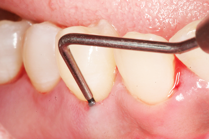Immagine descrittiva di Chirurgia Orale e Parodontale